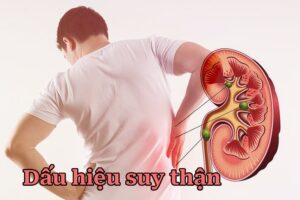 dấu hiệu suy thận