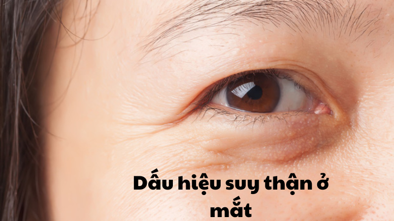 dấu hiệu suy thận ở mắt