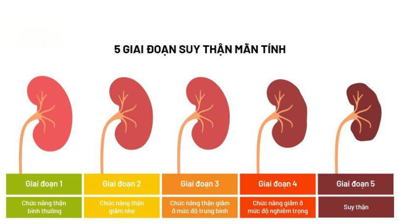 dấu hiệu suy thận từng giai đoạn