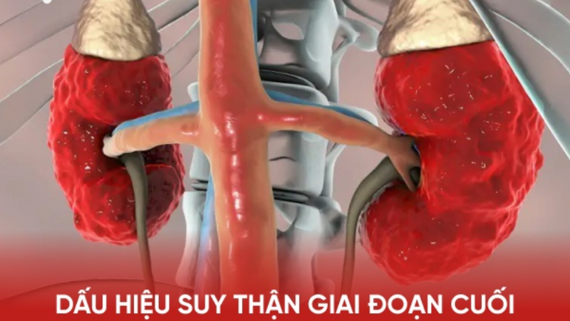 dấu hiệu suy thận