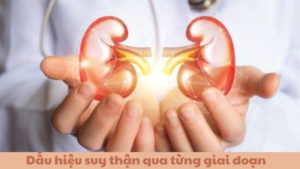 dấu hiệu suy thận từng giai đoạn