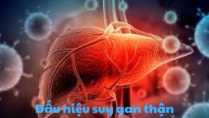 dấu hiệu suy gan thận