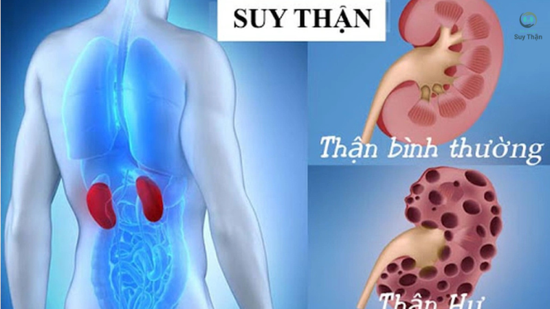 dấu hiệu của suy thận là gì